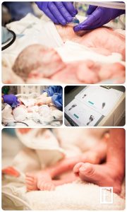 Delivery of Angel Twin